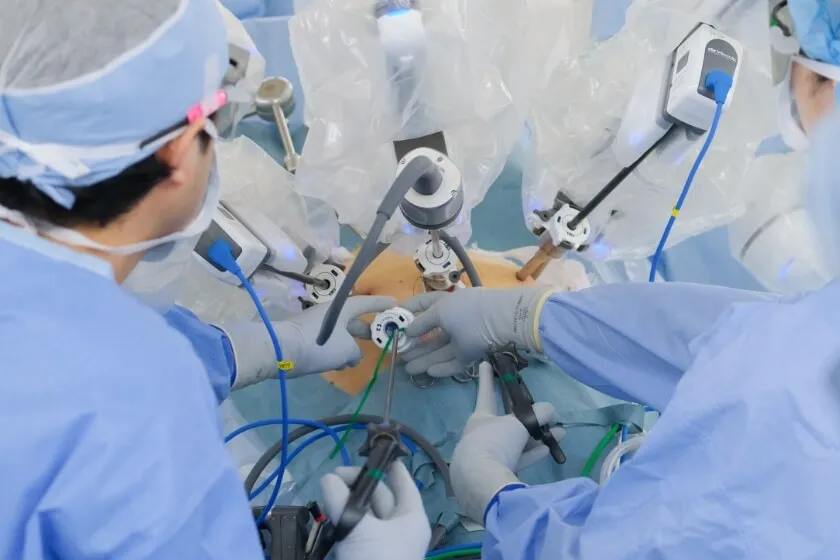 低侵襲手術支援ロボット ダヴィンチ イメージ