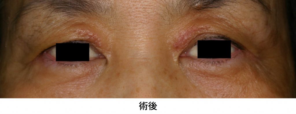 眼瞼黄色種 イメージ
