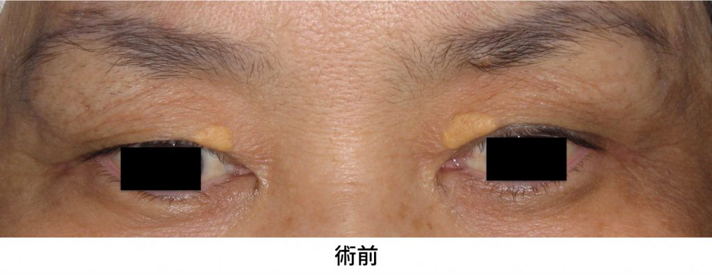 眼瞼黄色種 イメージ